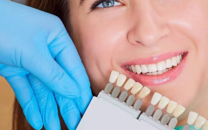Dental Veneers Fairless Hills PA
