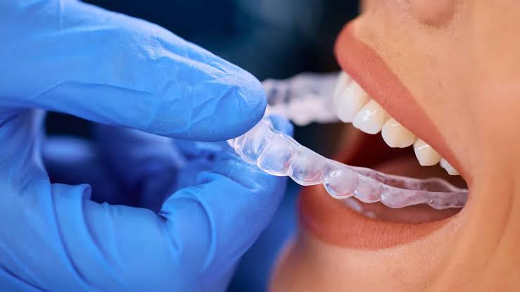 Invisalign Fairless Hills PA