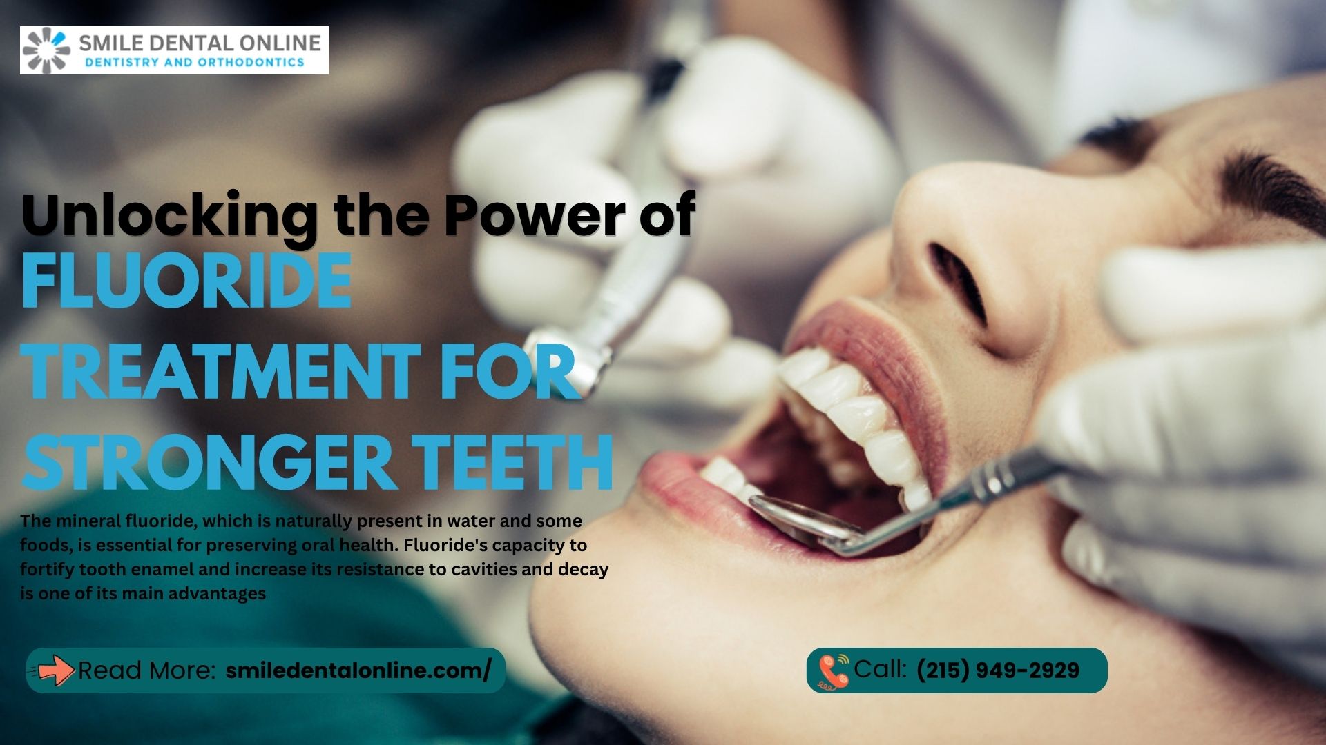 Unlocking the Power of Fluoride Treatment for Stronger Teeth